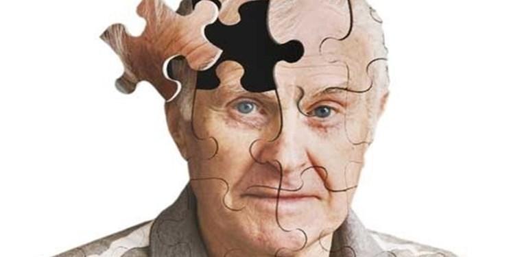 کشف تحولات مغز در جریان ابتلا به آلزایمر