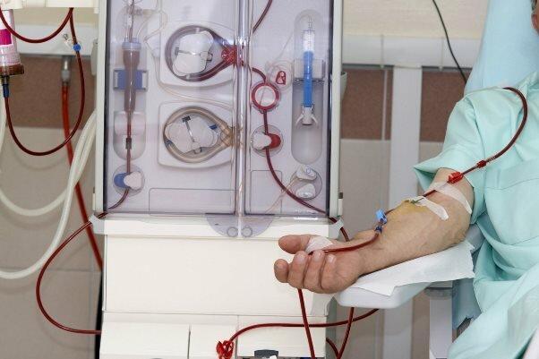 فراوری رگ های خونی در آزمایشگاه برای تسهیل دیالیز