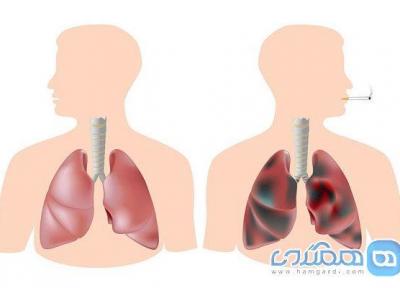 پاکسازی سریع ریه ، در سه روز از بیماری رهایی یابید