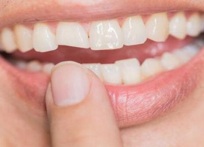 ترمیم دندان ها با سلول های بنیادی