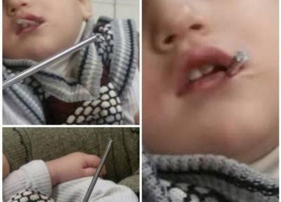 بازیگوشی پسر بچه مرندی حادثه آفرید