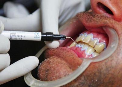 چرا در دوران کرونا دندانپزشکی پرخطر است؟