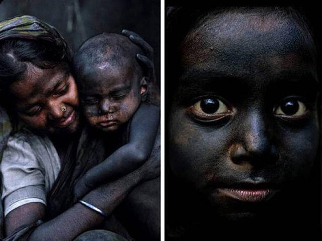 این بچه ها هر روز سیاه تر می شوند! این بچه ها هر روز سیاه تر می شوند!