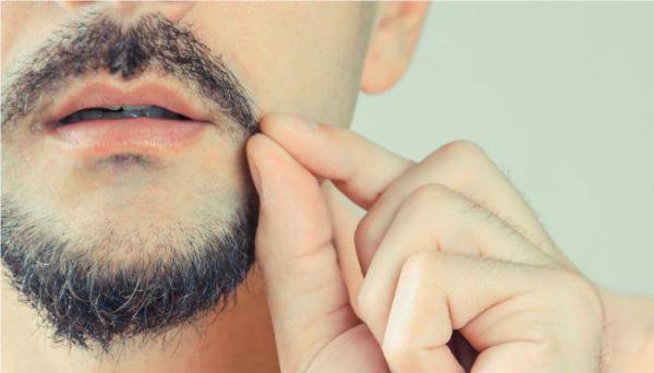 اختلال کندن موی وسواسی (تریکوتیلومانیا) چیست؟ اختلال کندن موی وسواسی (تریکوتیلومانیا) چیست؟