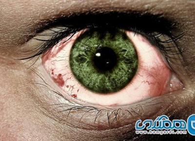 از دست دادن کوتاه مدت دید یا نابینایی موقتی