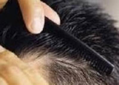 به خاطر چند تار مو