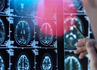 کشف راه چاره تشخیص آلزایمر تا 3 سال زودتر